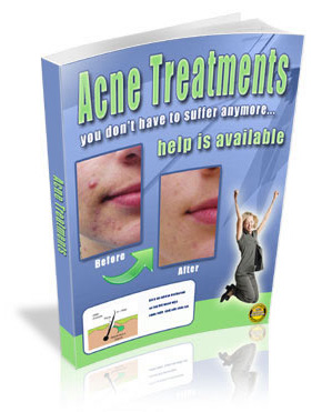 acne treatments