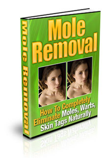 mole removal