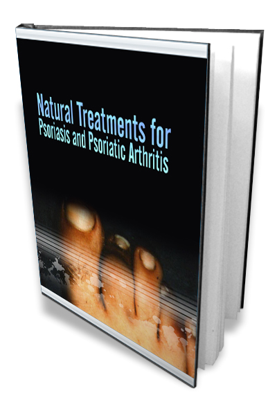 natural treatments psoriasis