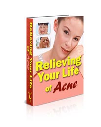 relieving your life acne